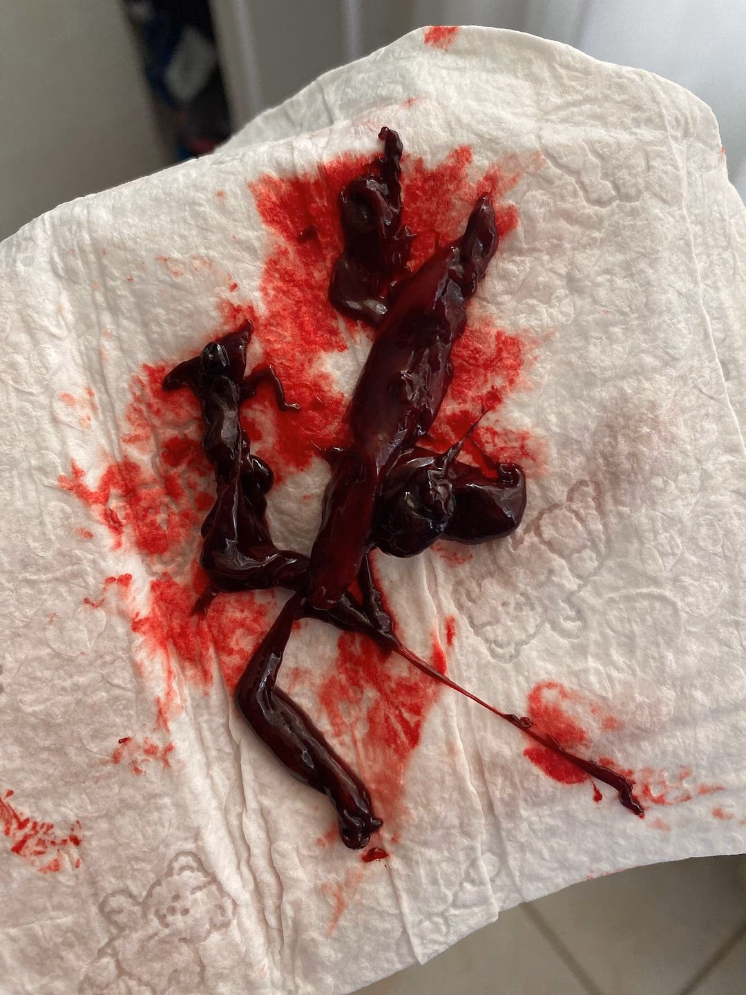 ¿Qué preguntas asustaron más que el aborto?