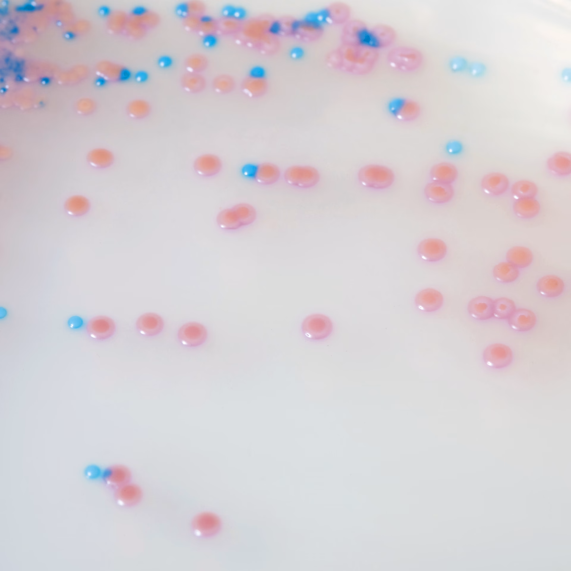 ¿Cómo se identifican las cepas de S. aureus?