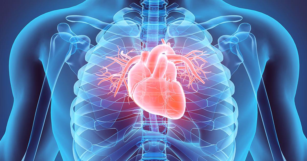 Are IVC filters dangerous?