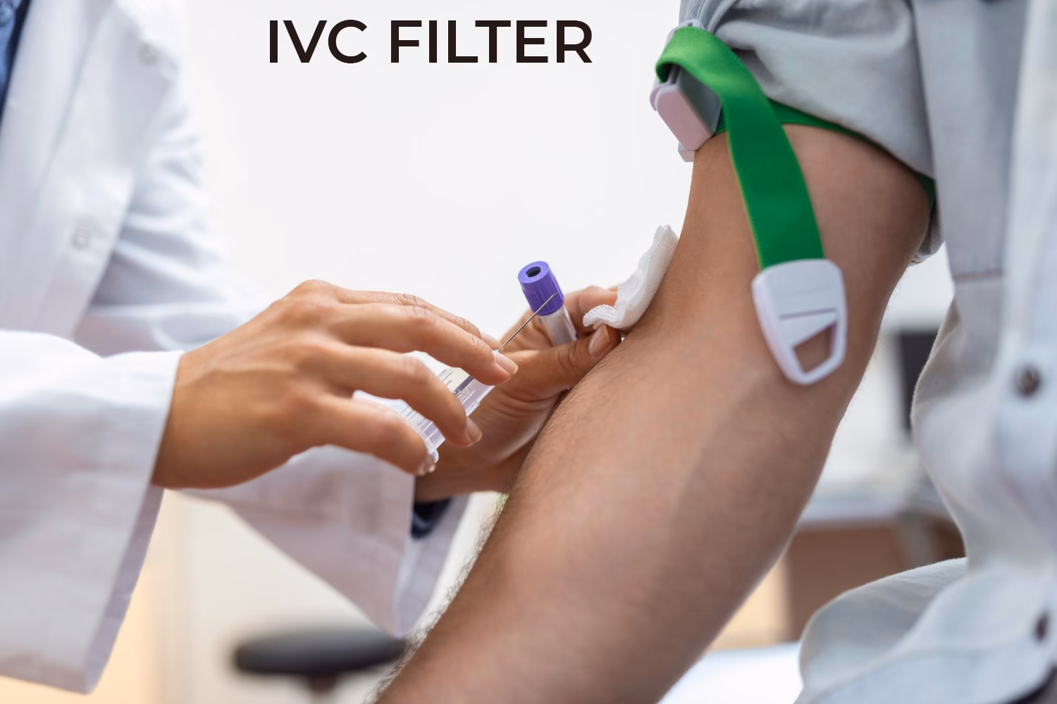Did a judge refuse to dismiss an IVC lawsuit against Bard?