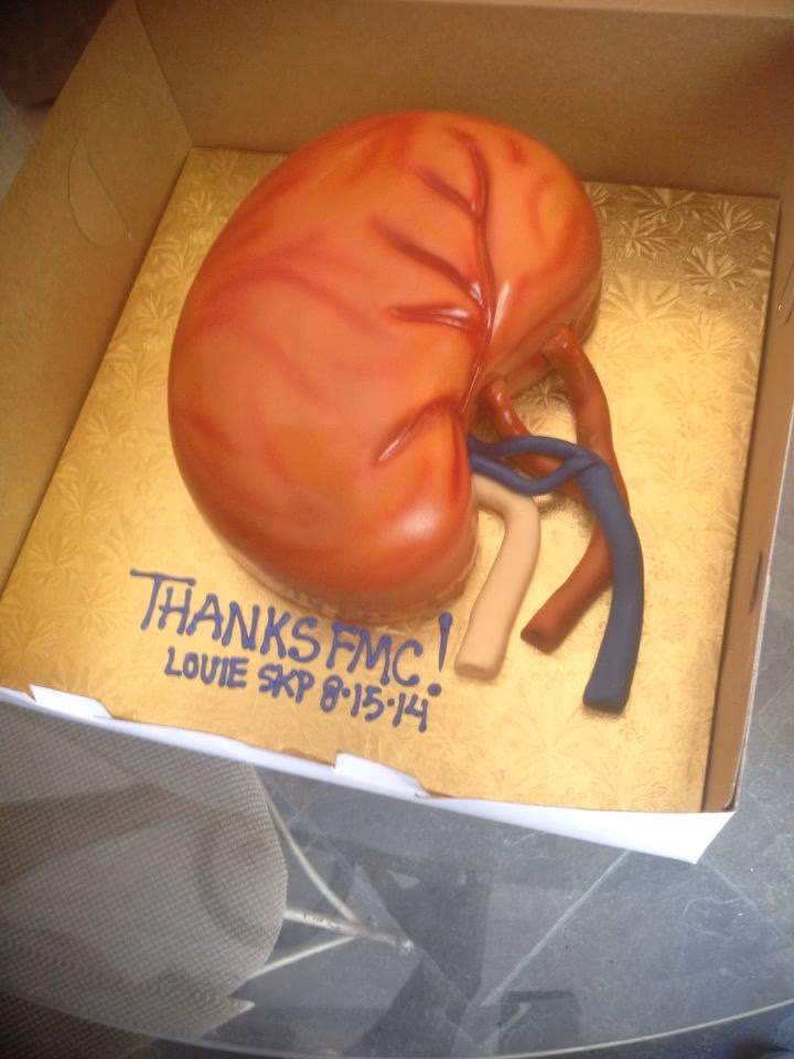 ¿Cómo hacer un riñón modelos?