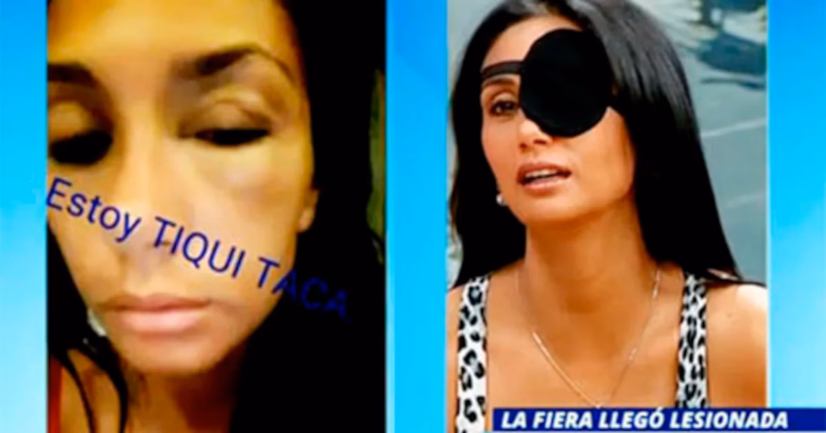 ¿Cuáles son los motivos de la parálisis de Pamela Ristori?